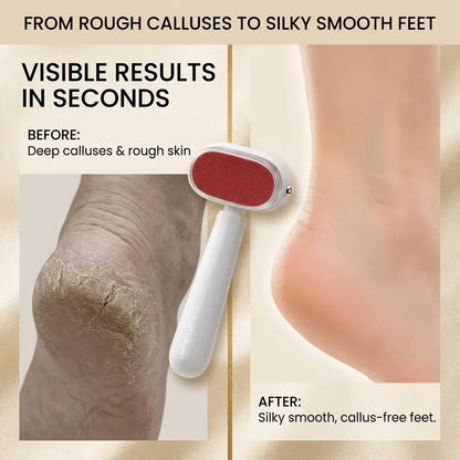 Foot Callus Remover