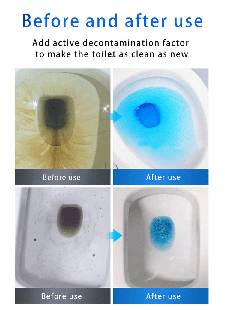 ⏰Last Day Surprise Price: 30% Off🔥SINK & DRAIN CLEANER