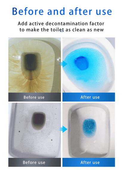 ⏰Last Day Surprise Price: 30% Off🔥SINK & DRAIN CLEANER
