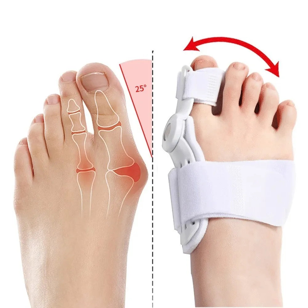 Orthopaedic Bunion Corrector